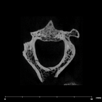 SK 854 Paranthropus robustus axis internal
