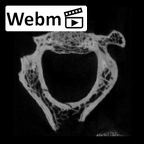 SK 854 Paranthropus robustus axis ct stack movie