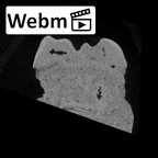 SK 856 Paranthropus robustus URM1 ct stack movie