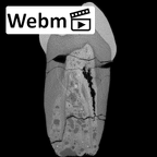 SK 857 Paranthropus robustus LRP3 ct stack movie