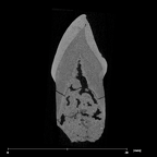 SK 85a Paranthropus robustus URC internal