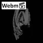SK 869 Paranthropus robustus partial mandible ct stack movie