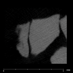 SK 870 Paranthropus robustus ULM3 root fragment 2 internal
