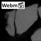 SK 870 Paranthropus robustus ULM3 root fragment 2 ct stack movie