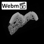 SK 871 Paranthropus robustus LLM3 ct stack movie
