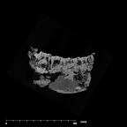 SK 876 Paranthropus robustus mandible internal