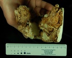 SK 876 Paranthropus robustus posterior photo