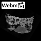 SK 876 Paranthropus robustus mandible ct stack movie