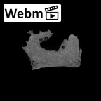 SK 879 Paranthropus robustus left temporal ct stack movie