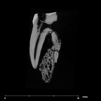 SK 881 Paranthropus robustus left maxilla LLP3 internal