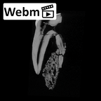 SK 881 Paranthropus robustus left maxilla ct stack movie