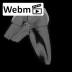 SK 91 Paranthropus robustus URDM1 ct stack movie