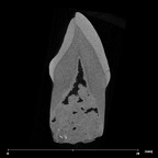 SK 93 Paranthropus robustus ULC internal