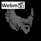 SK 96 Paranthropus robustus LLDM1 ct stack movie