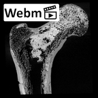 SK 97 Paranthropus robustus right femur proximal ct stack movie