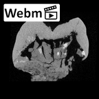SK 98 Paranthropus robustus ULM2 ct stack movie