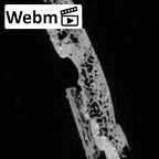 DV-STERN Homo sapiens sternum ct stack movie