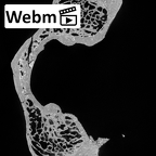 DV13-29 Homo sapiens atlas ct stack movie