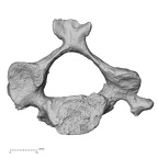 DV13-31 Homo sapiens cervical vertebra third inferior