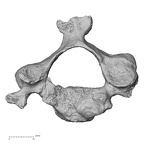 DV13-31 Homo sapiens cervical vertebra third superior
