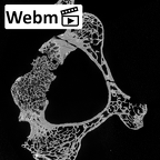 DV13-31 Homo sapiens cervical vertebra third ct stack movie