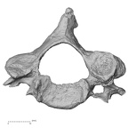 DV13-32 Homo sapiens cervical vertebra fourth superior