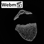 DV13-42 Homo sapiens thoracic vertebra seventh ct stack movie