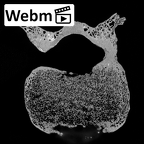 DV13-46 Homo sapiens thoracic vertebra eleventh ct stack movie