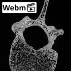 DV13-47 Homo sapiens thoracic vertebra twelfth ct stack movie