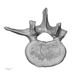 DV13-50 Homo sapiens lumbar vertebra third superior