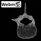 DV13-50 Homo sapiens lumbar vertebra third ct stack movie