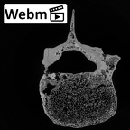DV13-51 Homo sapiens lumbar vertebra fourth ct stack movie