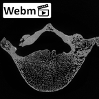 DV13-52 Homo sapiens lumbar vertebra fifth ct stack movie