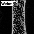 DV13-54 Homo sapiens sternum ct stack movie
