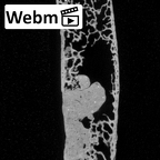 DV13-55 Homo sapiens sternum ct stack movie