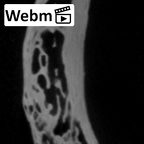 DV13-79 Homo sapiens rib twelfth right ct stack movie