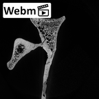 DV14-102 Homo sapiens scapula right ct stack movie