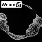 DV14-40 Homo sapiens atlas ct stack movie