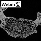 DV14-45 Homo sapiens cervical vertebra fifth ct stack movie