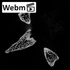 DV14-51 Homo sapiens thoracic vertebra third ct stack movie