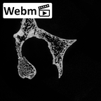 DV14-52 Homo sapiens thoracic vertebra fourth ct stack movie