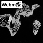 DV14-55 Homo sapiens thoracic vertebra seventh ct stack movie
