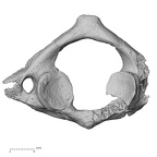 DV15-35 Homo sapiens atlas inferior