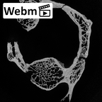 DV15-35 Homo sapiens atlas ct stack movie