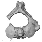 DV15-36 Homo sapiens axis superior