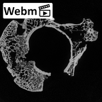 DV15-36 Homo sapiens axis ct stack movie