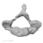 DV15-40 Homo sapiens cervical vertebra fifth inferior