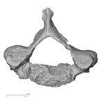 DV15-40 Homo sapiens cervical vertebra fifth superior