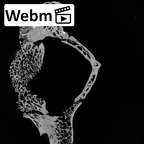 DV15-40 Homo sapiens cervical vertebra fifth ct stack movie