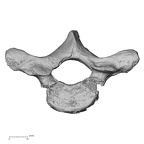 DV15-45 Homo sapiens thoracic vertebra first superior